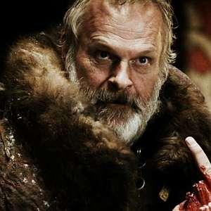 Part of <i>Game of Thrones</i> Actor Clive Mantle's Ear Bitten Off in Altercation