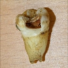 John Lennon's Tooth Up For Auction