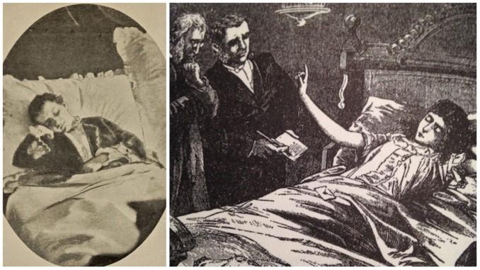 The "Fasting Girl": A Victorian Phenomenon That Made Starvation Trendy