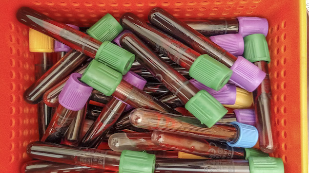 Blood Tests May Be the Future of Diagnosing Children with Autism